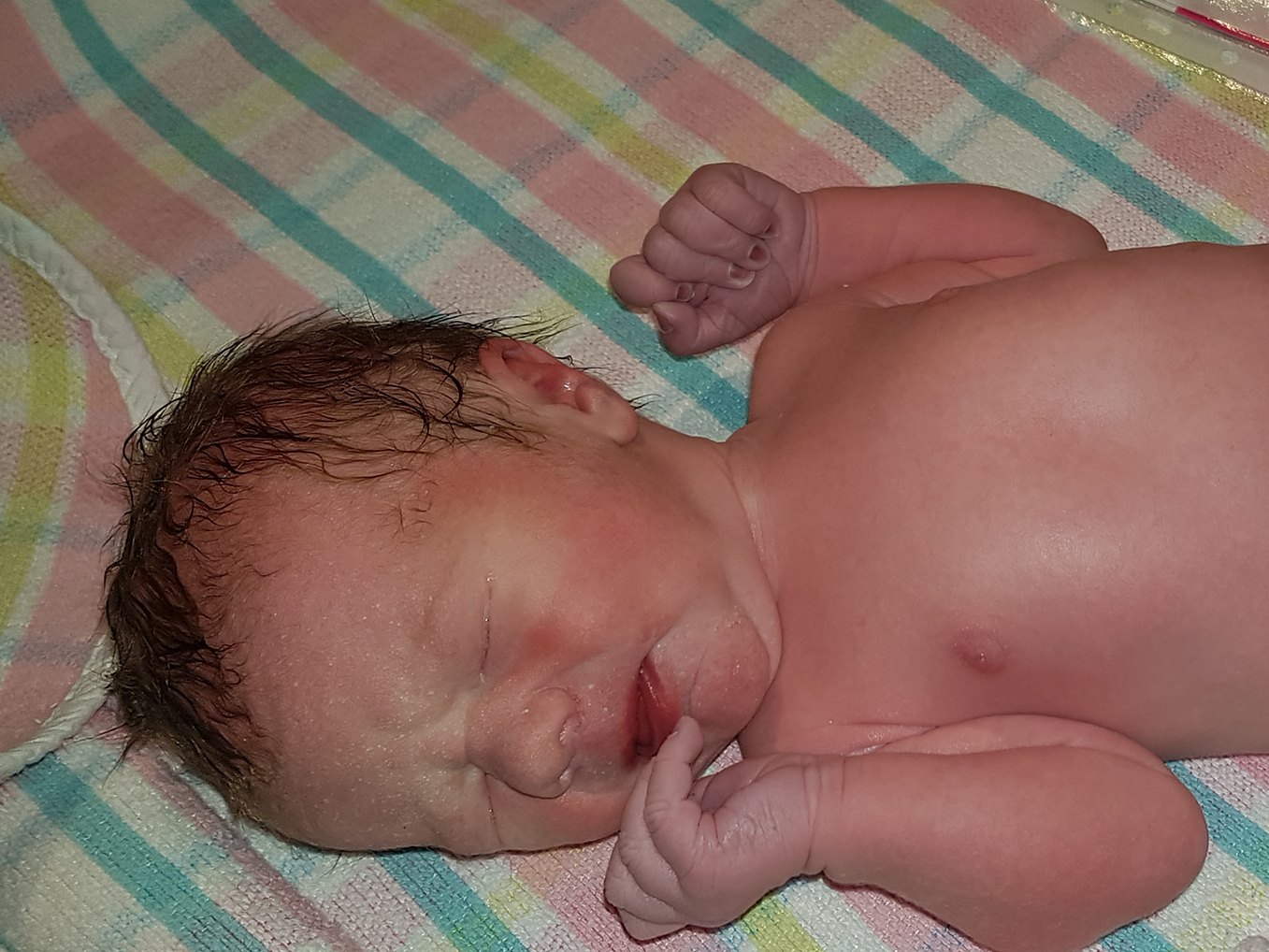 A newborn baby lying on a striped hospital blanket, eyes closed